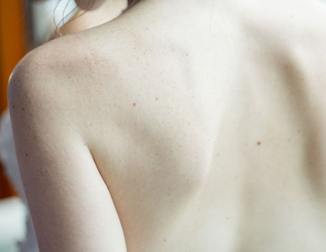 «Odylique»: 5 шагов, которые помогут коже, склонной к аллергии